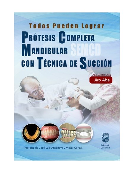 Prótesis Completa Mandibular con Técnica de Succión Efectiva- Jiro Abe