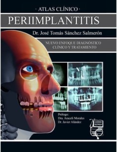 Atlas Clínico de Periimplantitis "Nuevo Enfoque Diagnóstico Clínico y Tratamiento"