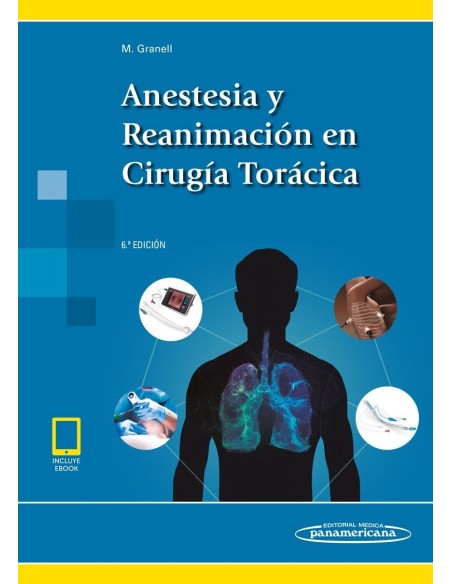 Anestesia y Reanimación en Cirugía Torácica (incluye eBook)