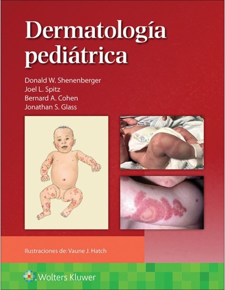 Dermatología Pediátrica