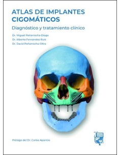 Atlas de Implantes Cigomáticos "Diagnóstico y Tratamiento Clínico"