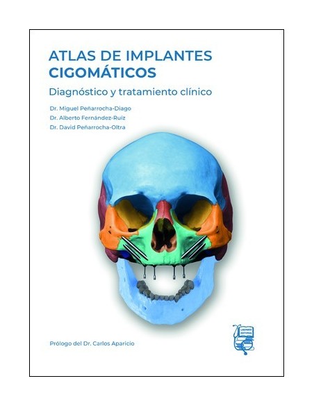 Atlas de Implantes Cigomáticos "Diagnóstico y Tratamiento Clínico"