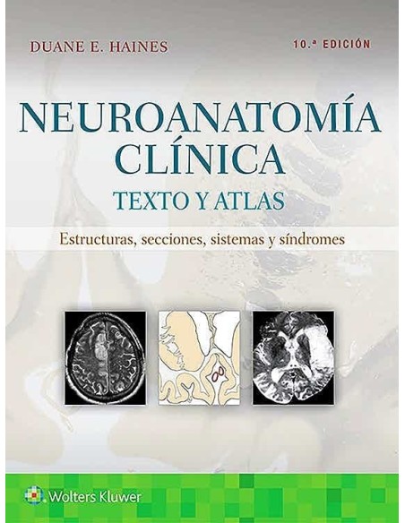 Neuroanatomía Clínica. Texto y Atlas. Estructuras
