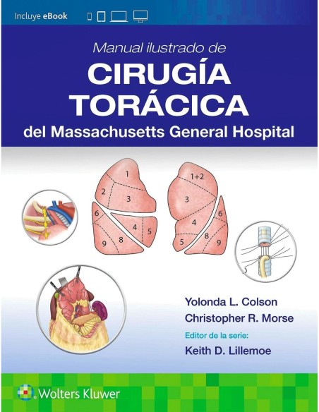 Manual ilustrado de Cirugía torácica del Massachusetts General Hospital