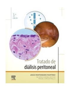 Tratado de diálisis peritoneal 3 edición