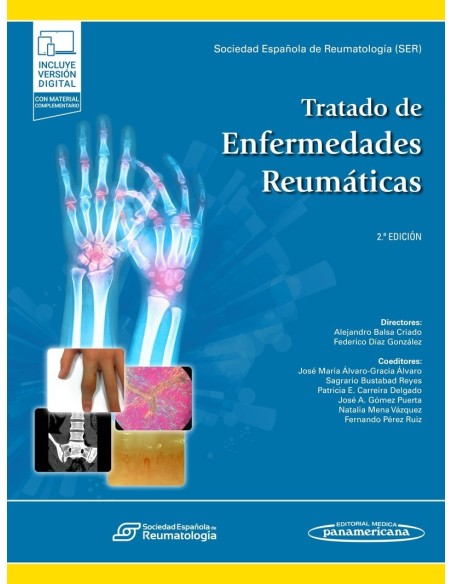 Tratado de Reumatología