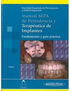 Manual S.E.P.A. de Periodoncia y Terapéutica de Implantes. Fundamentos y guía práctica