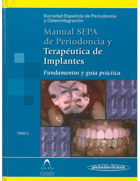 Manual S.E.P.A. de Periodoncia y Terapéutica de Implantes. Fundamentos y guía práctica