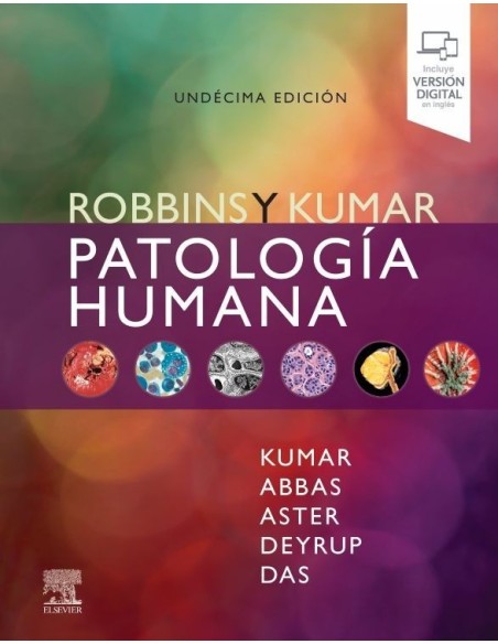 Robbins y Kumar. Patología humana