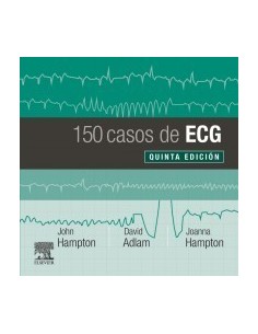 150 casos de ECG