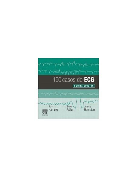 150 casos de ECG