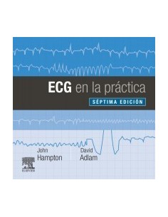 ECG en la práctica