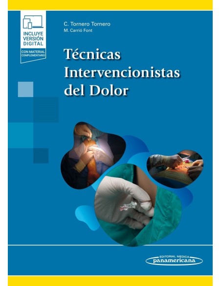 Técnicas Intervencionistas del Dolor
