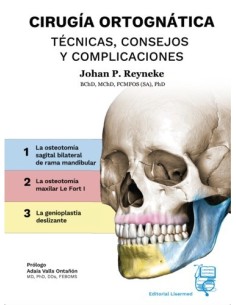 Cirugía Ortognática - Técnicas