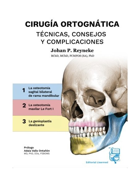 Cirugía Ortognática - Técnicas