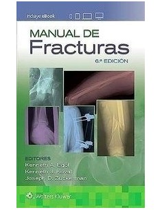 Manual de fracturas 6 edición