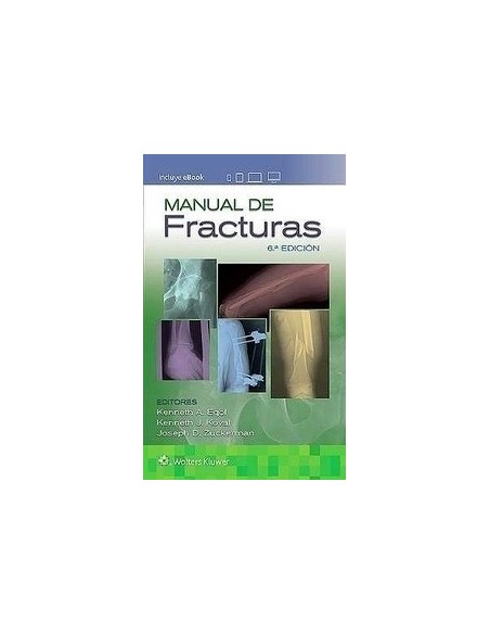 Manual de fracturas 6 edición