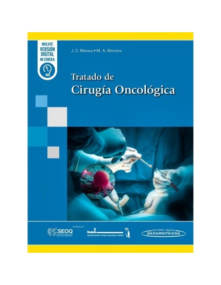 Tratado de Cirugía Oncológica