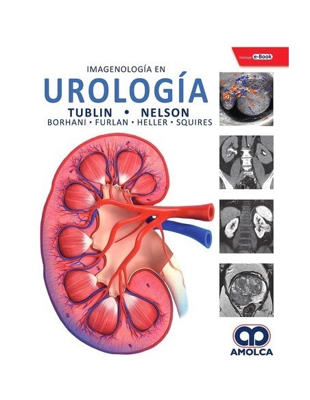 Imagenología en Urología + e-Book