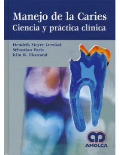 Manejo de la Caries. Ciencia y Practica Clínica
