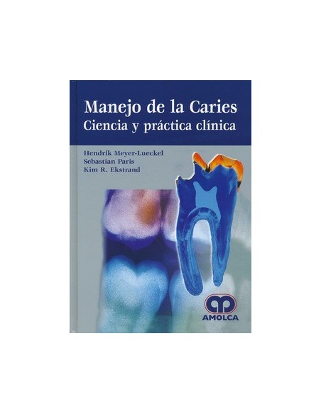 Manejo de la Caries. Ciencia y Practica Clínica