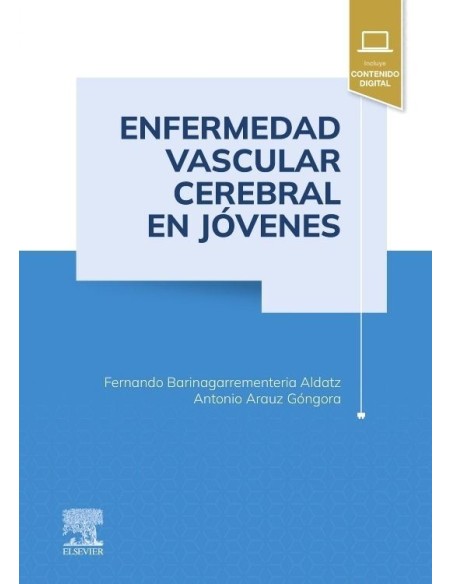 Enfermedad vascular cerebral en jóvenes