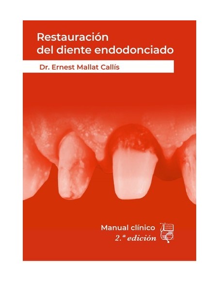 Manual de Restauración del Diente Endodonciado