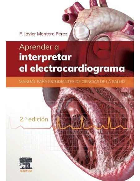 Aprender a interpretar el electrocardiograma