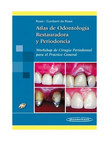 Atlas de Odontología Restauradora y Periodoncia Workshop de cirugía periodontal para el práctico general