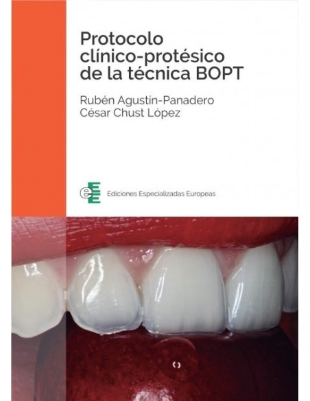 Protocolo clínico-protésico de la técnica BOPT