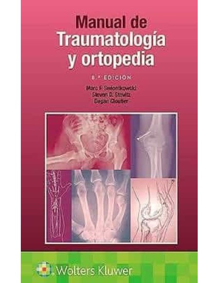 Manual de Traumatología y Ortopedia