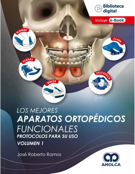 Los Mejores Aparatos Ortopédicos Funcionales. Protocolos para Su Uso