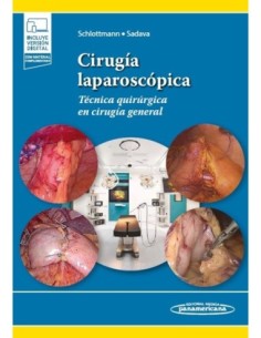 Cirugía laparoscópica Técnica quirúrgica en cirugía general