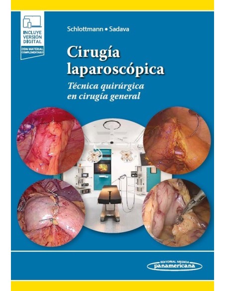 Cirugía laparoscópica Técnica quirúrgica en cirugía general