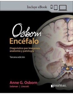 Osborn Encéfalo Diagnóstico por imágenes
