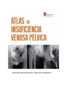 Atlas de Insuficiencia Venosa Pélvica