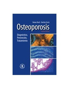 osteoporosis-diagnostico-prevencion-y-tratamiento-2-ed