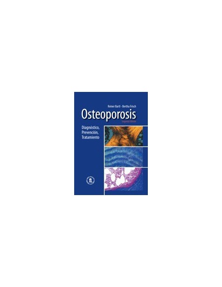 osteoporosis-diagnostico-prevencion-y-tratamiento-2-ed