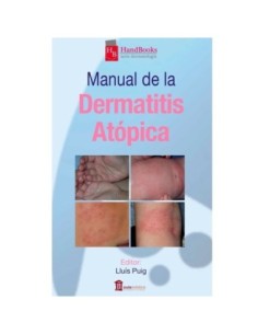 Manual de la dermatitis atópica