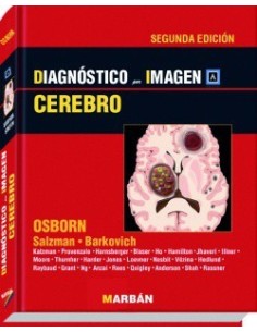 diagnostico-por-imagen-cerebro