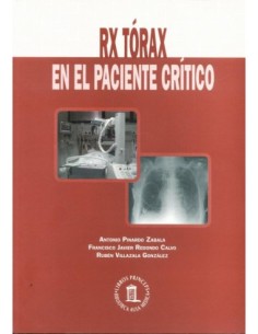 RX Tórax en el Paciente Crítico