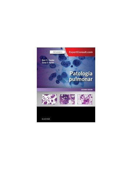 Patología Pulmonar 2ª edición