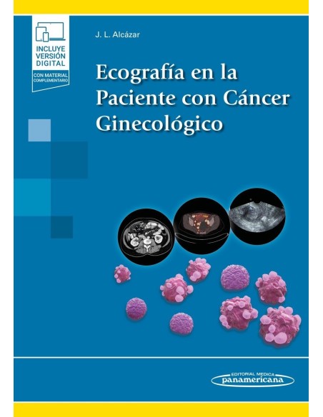Ecografía en la Paciente con Cáncer Ginecológico