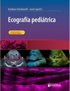 Ventilación mecánica en anestesia y cuidados críticos