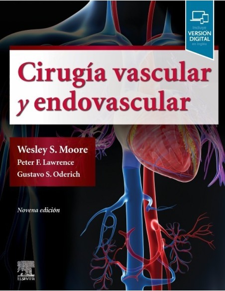 Cirugía vascular y endovascular: Una revisión exhaustiva
