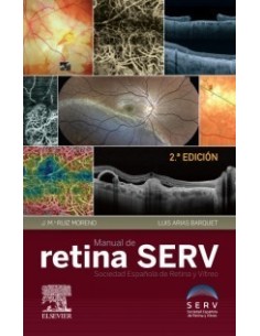 Manual de retina SERV