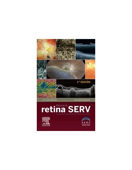 Manual de retina SERV