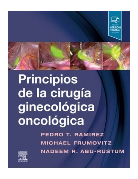 Principios de la cirugía ginecológica oncológica