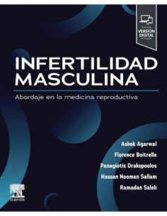 Infertilidad masculina