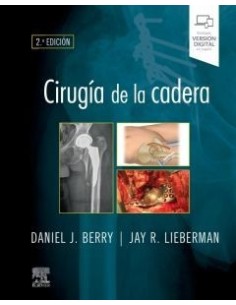 Cirugía de la cadera 2ª edición